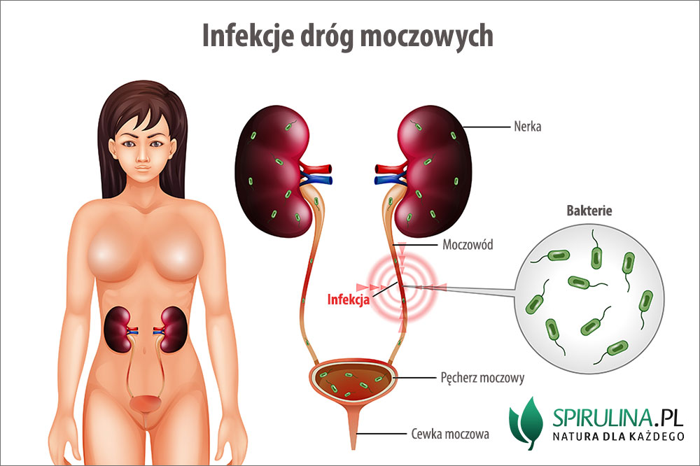 pieluchomajtki zduńska wola pefron