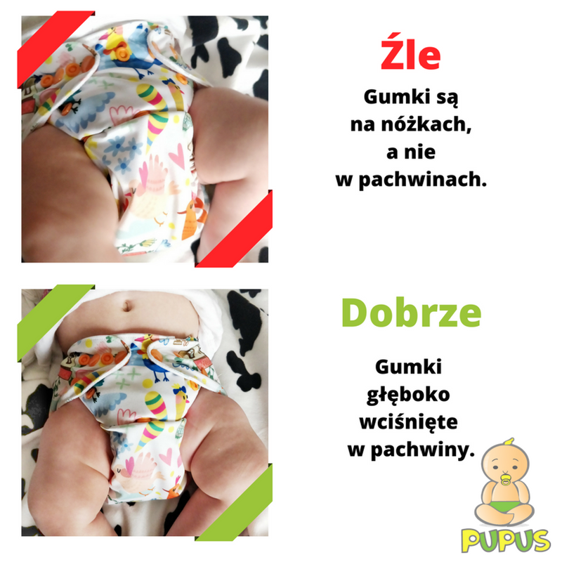 Post natal belt